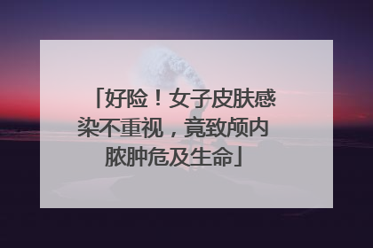好险！女子皮肤感染不重视，竟致颅内脓肿危及生命